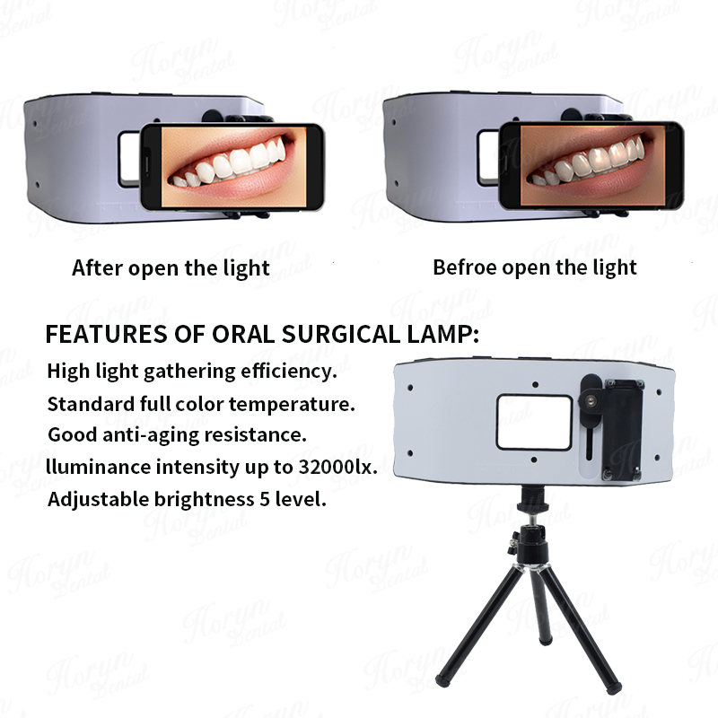 Dental Flash Light Photography - Photography Lighting Flash recension och pris